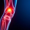 Артроз и сахарный диабет: взаимосвязь и лечение