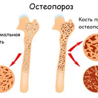 Зеленый древесный варан: загадочный обитатель тропических лесов