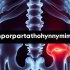 Когда суставы и кости подсказывают: как распознать гиперпаратиреоз по поражению опорно-двигательного аппарата