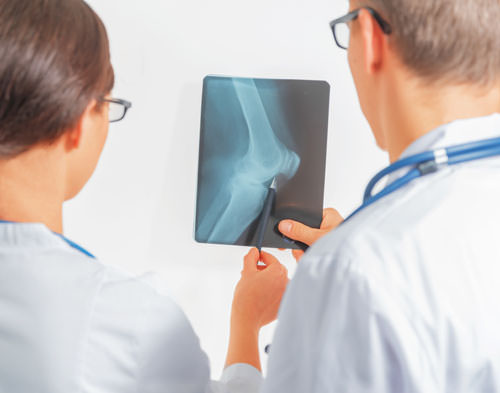 Лечение деформирующего артроза коленного сустава