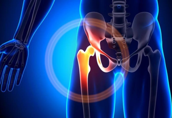 Болит тазобедренный сустав - причины, что делать и как лечить