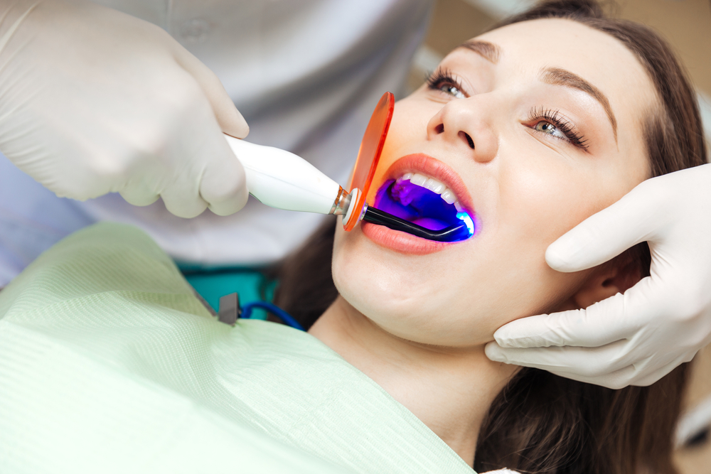 Как отбеливают зубы в стоматологии?