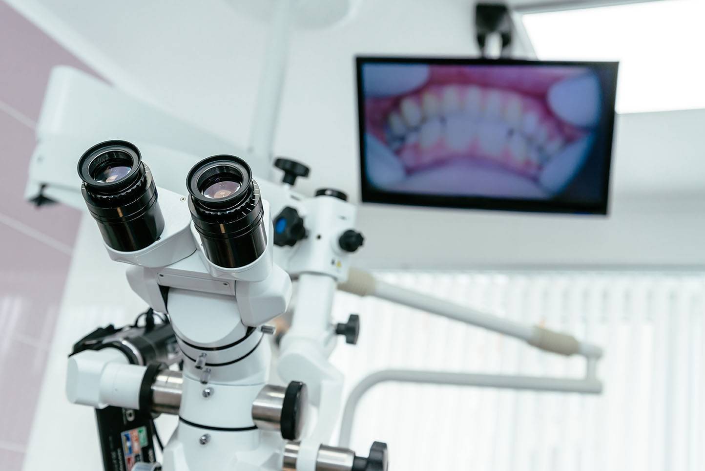 Плюсы лечения зубов под микроскопом