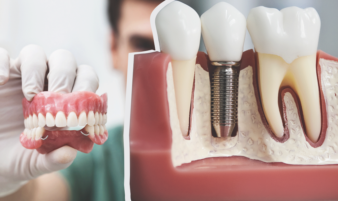 Протезирование зубов: современные технологии и методы