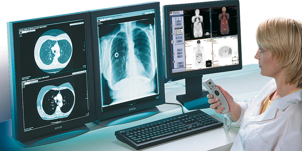 Как компьютерная томография помогает выявлять заболевания легких