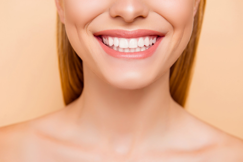 Виниры для зубов: идеальная улыбка без усилий