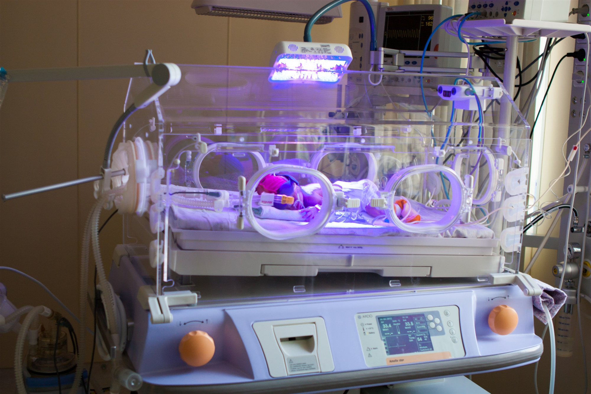 Неонатальное оборудование: защита и поддержка жизни новорожденных